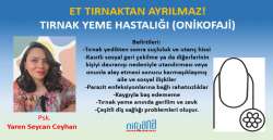 ET TIRNAKTAN AYRILMAZ! TIRNAK YEME HASTALIĞI (ONİKOFAJİ)